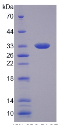 SDS PAGE (Tnfaip6-1417M).jpg